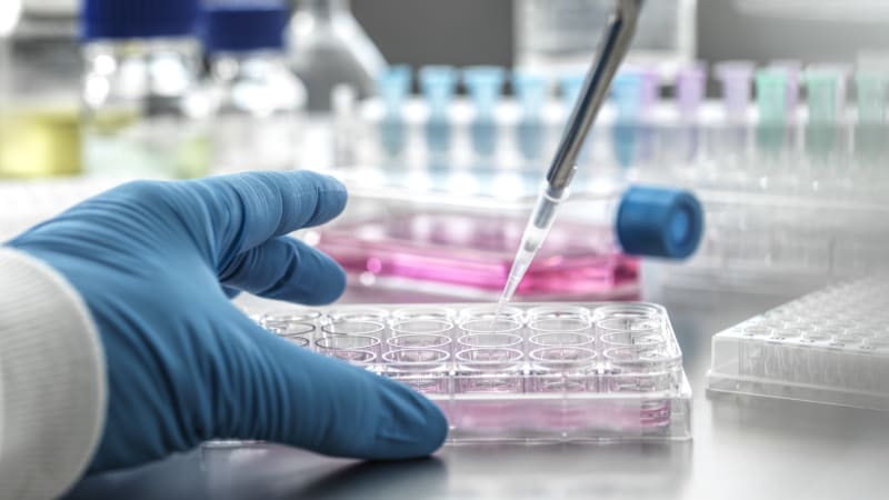 Virus ptačí chřipky H5N5 se poprvé přenesl na člověka. Usmrtil chovatele drůbeže v USA